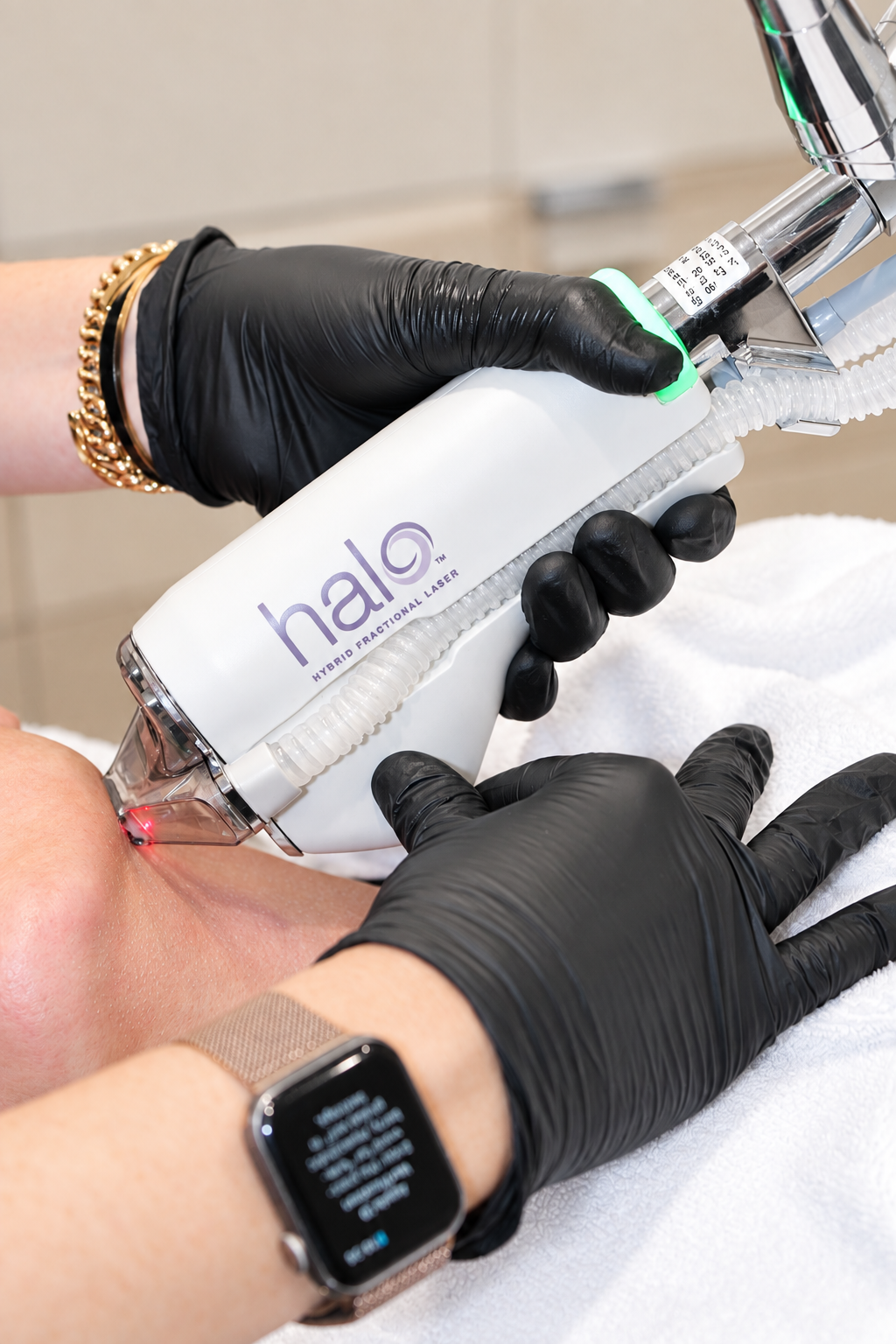 Halo laser treatment