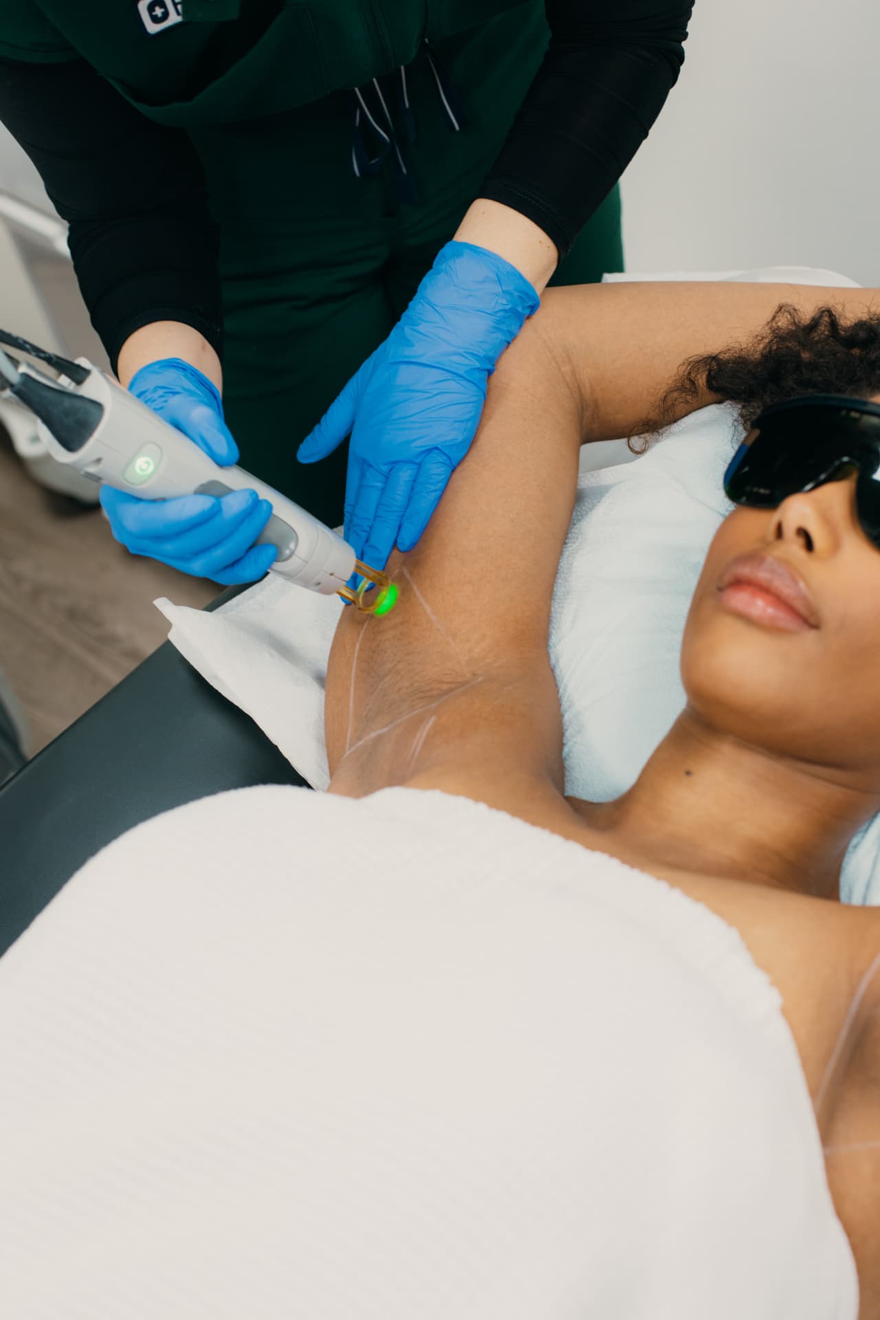 Laser hair removal