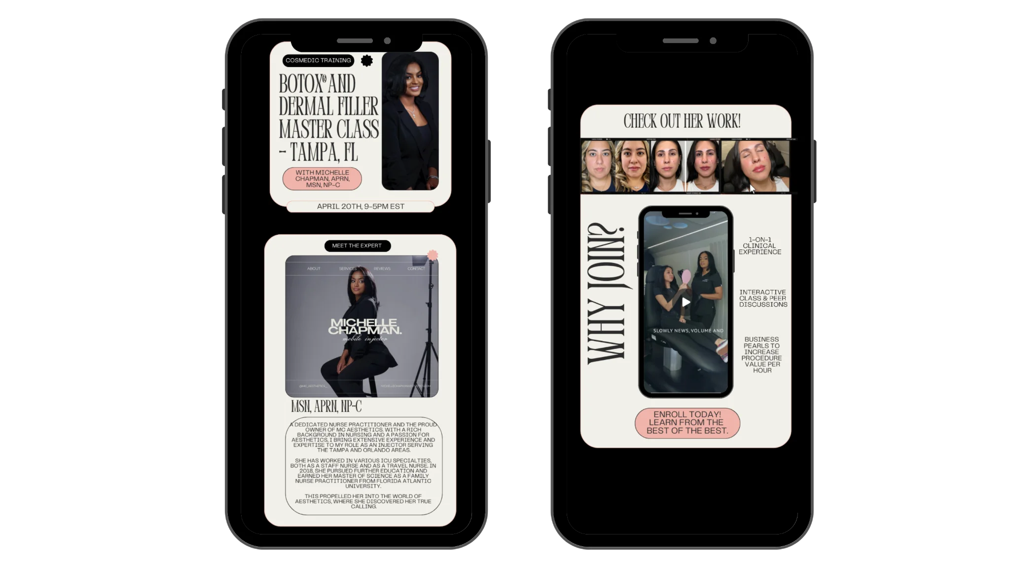 Mobile campaign creative showing Botox & Dermal Filler Master Class promotional email and SMS designs with two phone mockups